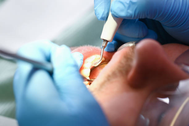 Best Emergency Treatment for Oral Infections in Deltana, AK